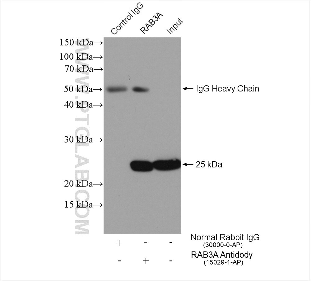 Immunoprecipitation (IP) experiment of mouse brain tissue using RAB3A Polyclonal antibody (15029-1-AP)