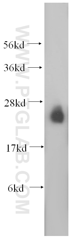 RAB3A Polyclonal antibody