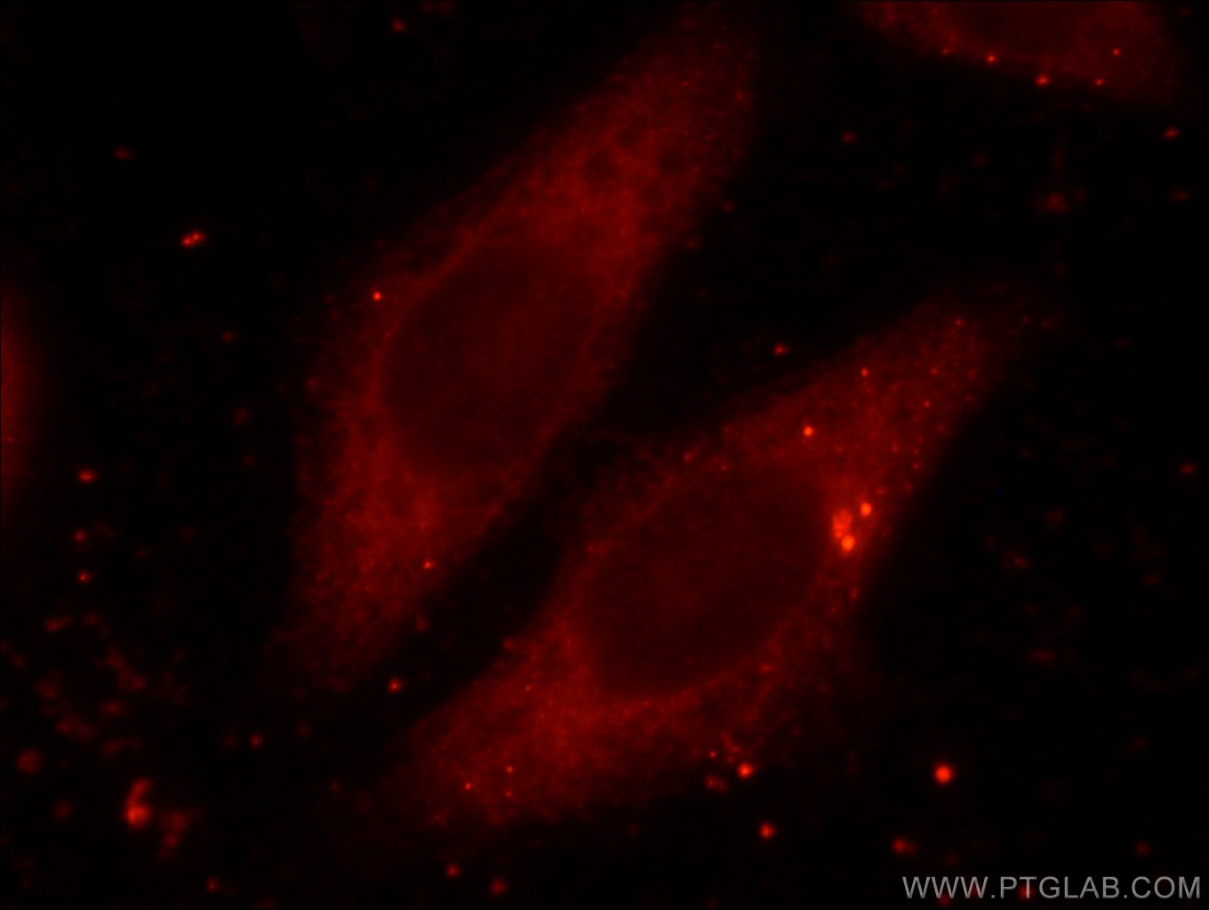 Immunofluorescence (IF) / fluorescent staining of HeLa cells using RAB3A-specific Polyclonal antibody (16865-1-AP)