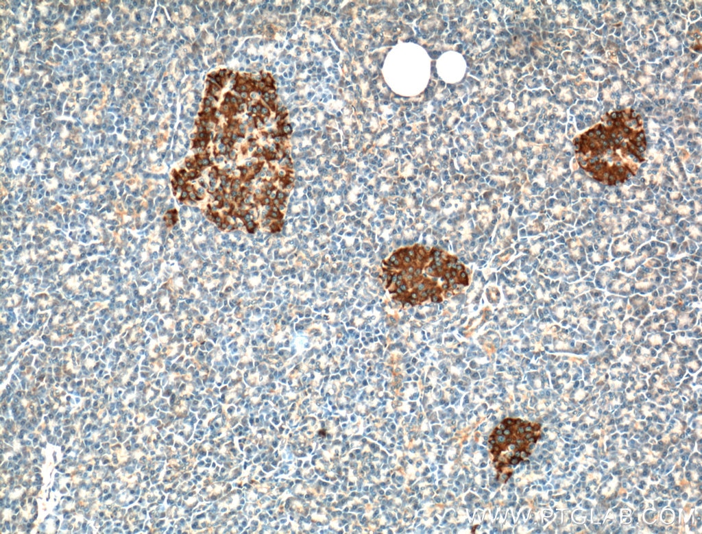 Immunohistochemistry (IHC) staining of human pancreas tissue using RAB3A-specific Polyclonal antibody (16865-1-AP)