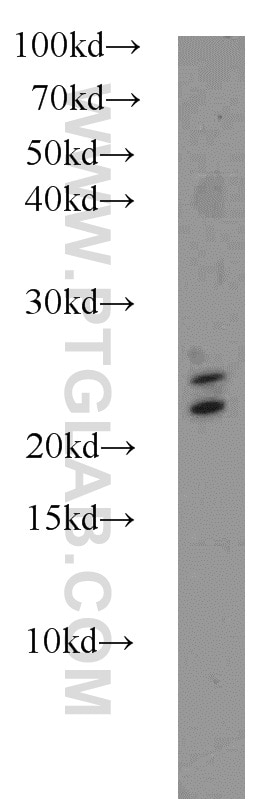 Western Blot (WB) analysis of mouse brain tissue using RAB3A-specific Polyclonal antibody (16865-1-AP)