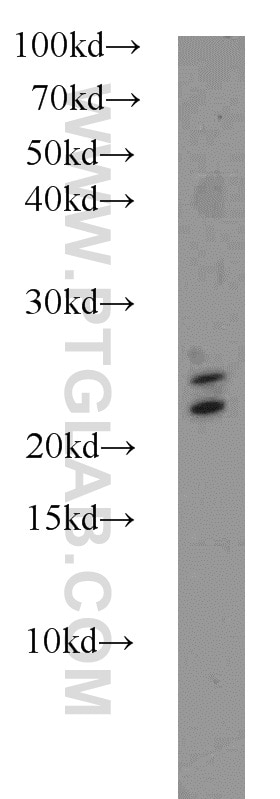 WB analysis of mouse brain using 16865-1-AP