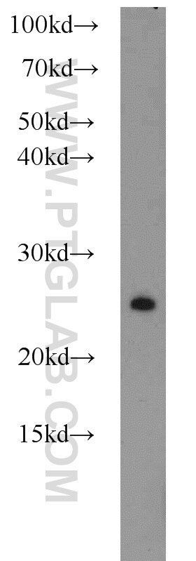 Western Blot (WB) analysis of rat brain tissue using RAB3A-specific Polyclonal antibody (16865-1-AP)