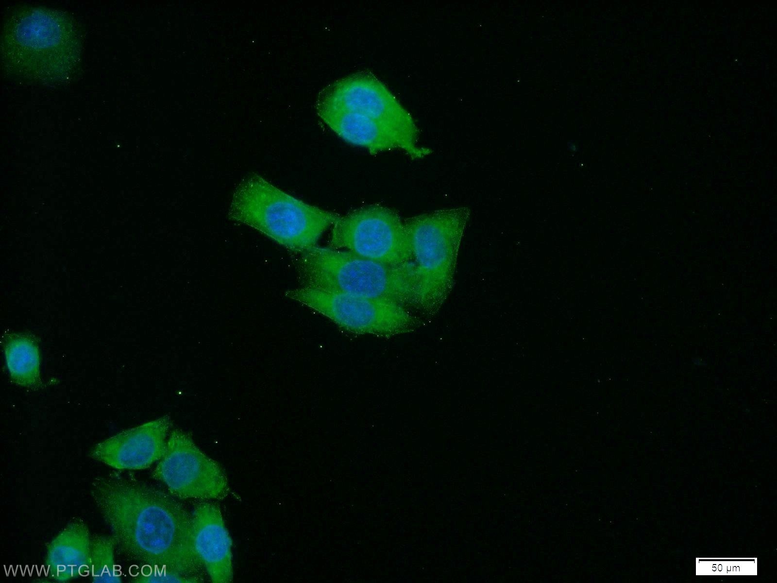 Immunofluorescence (IF) / fluorescent staining of HeLa cells using RAB3B/C Polyclonal antibody (15774-1-AP)