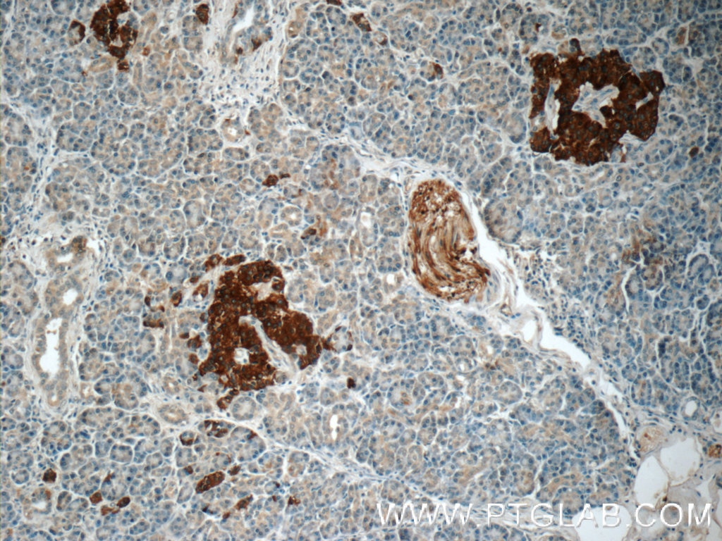 Immunohistochemistry (IHC) staining of human pancreas tissue using RAB3B/C Polyclonal antibody (15774-1-AP)