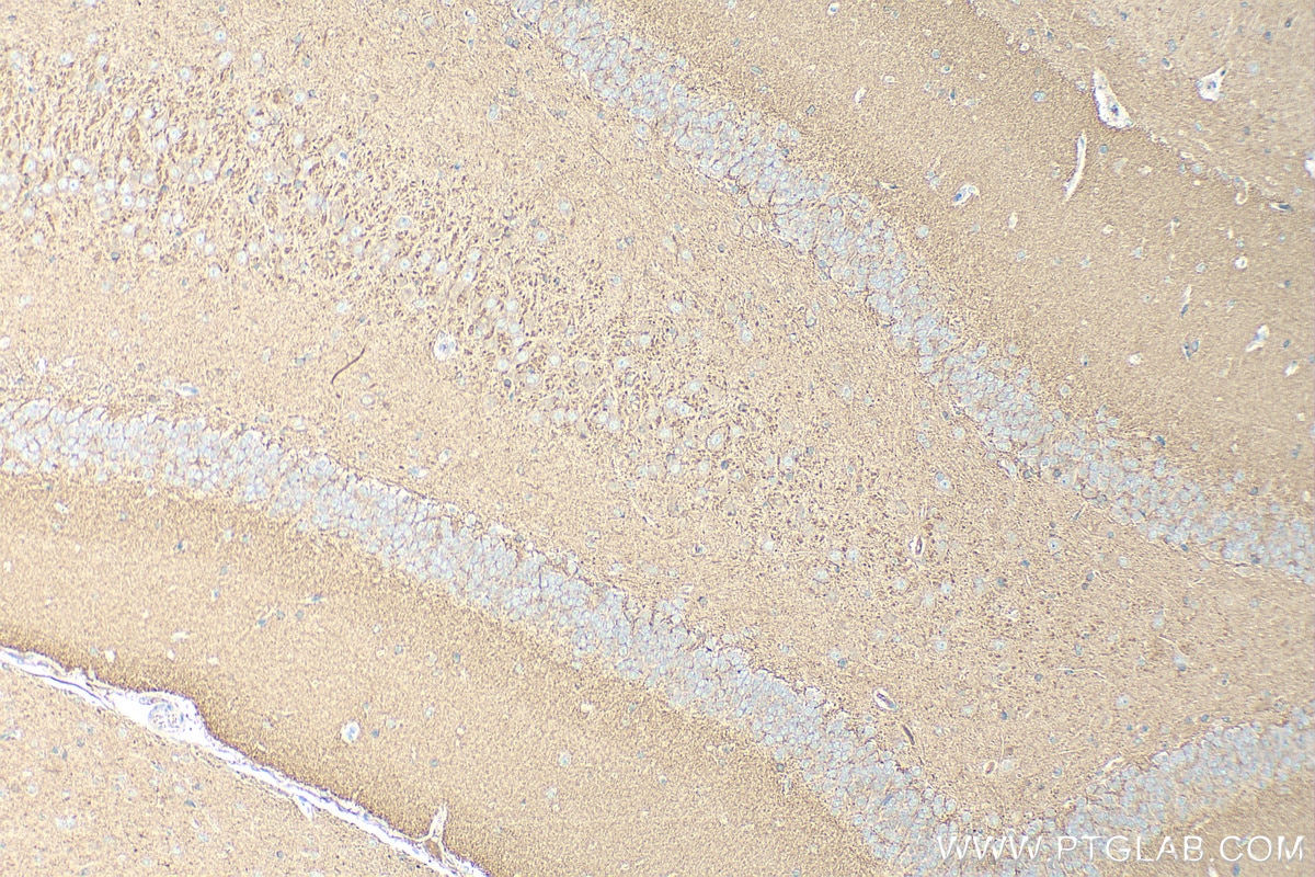 Immunohistochemistry (IHC) staining of rat brain tissue using RAB3B/C Polyclonal antibody (15774-1-AP)