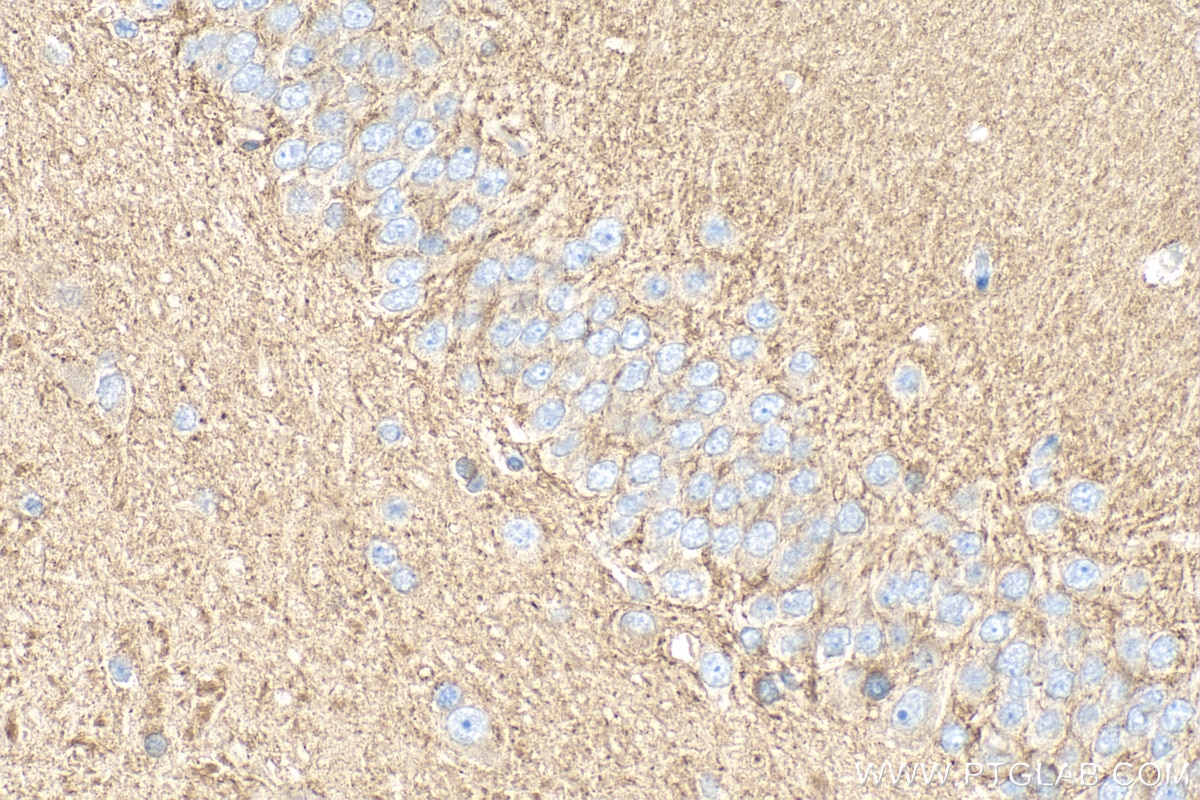 Immunohistochemistry (IHC) staining of rat brain tissue using RAB3B/C Polyclonal antibody (15774-1-AP)