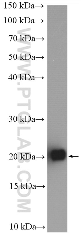 Western Blot (WB) analysis of U-251 cells using RAB3B/C Polyclonal antibody (15774-1-AP)