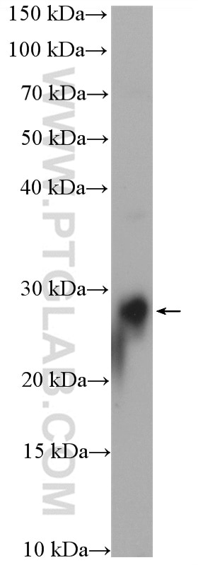 Western Blot (WB) analysis of mouse brain tissue using RAB3B/C Polyclonal antibody (15774-1-AP)