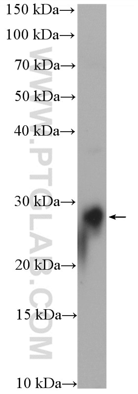 WB analysis of mouse brain using 15774-1-AP