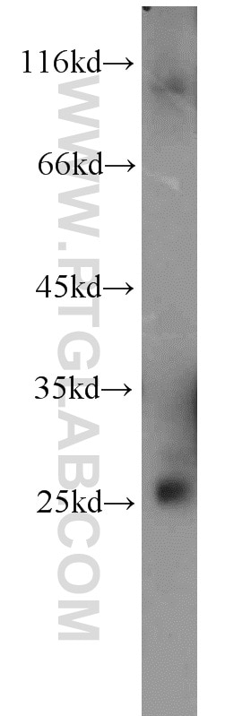 Western Blot (WB) analysis of human brain tissue using RAB3B/C Polyclonal antibody (15774-1-AP)