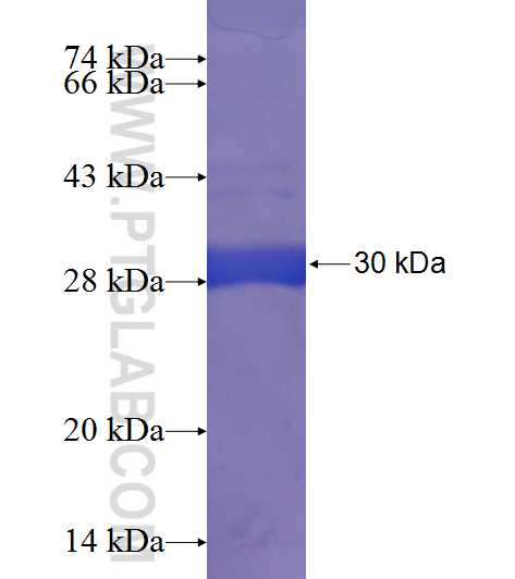 RAB3B fusion protein Ag23862 SDS-PAGE