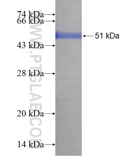 RAB3B fusion protein Ag8441 SDS-PAGE