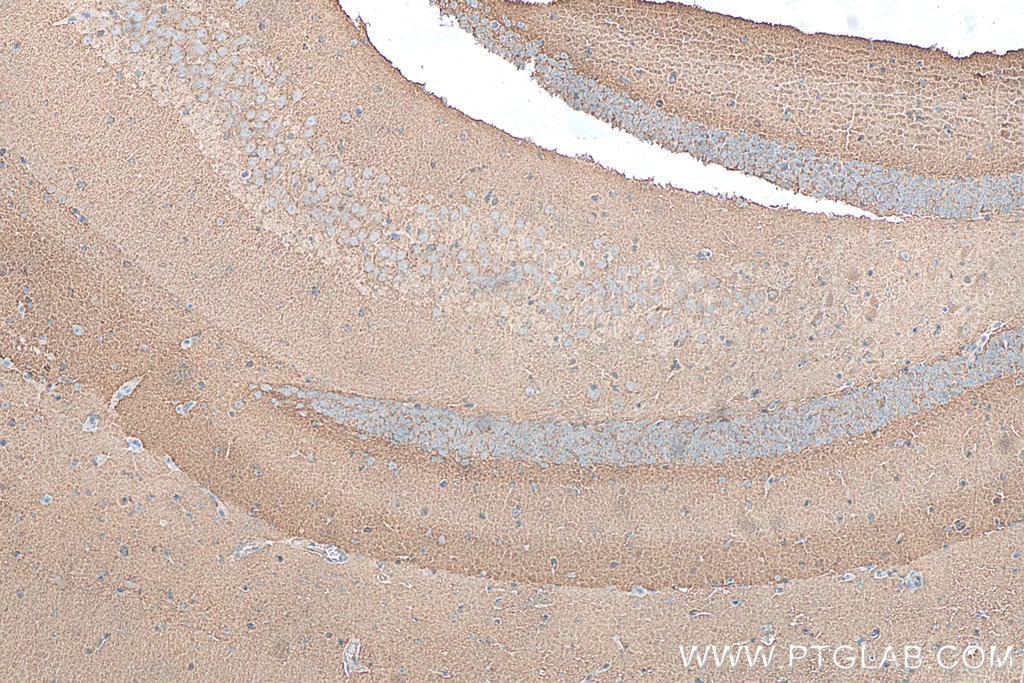 IHC staining of mouse brain using 10788-1-AP