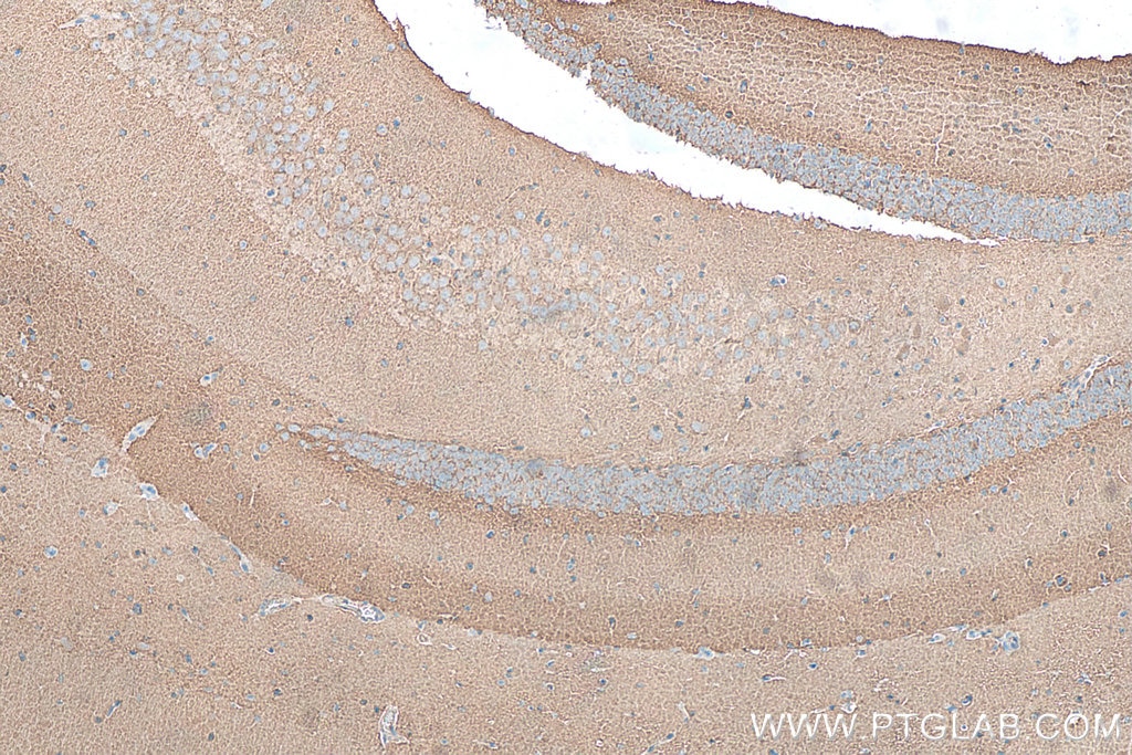 Immunohistochemistry (IHC) staining of mouse brain tissue using RAB3C Polyclonal antibody (10788-1-AP)