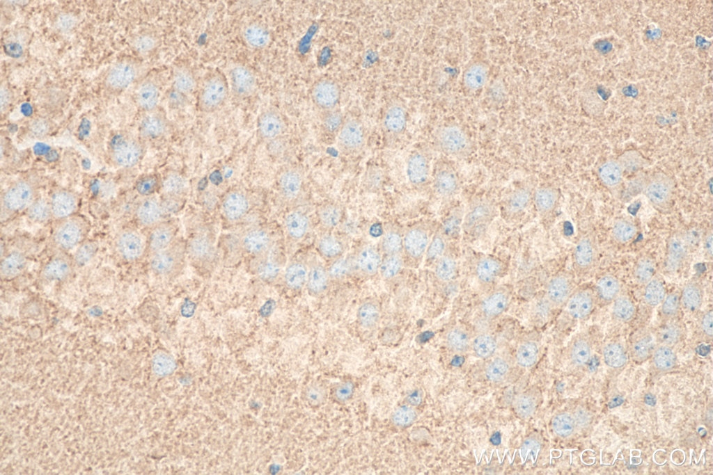 Immunohistochemistry (IHC) staining of mouse brain tissue using RAB3C Polyclonal antibody (10788-1-AP)