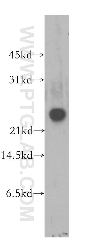 Western Blot (WB) analysis of human brain tissue using RAB3C Polyclonal antibody (10788-1-AP)