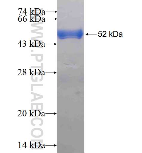 RAB3C fusion protein Ag1241 SDS-PAGE
