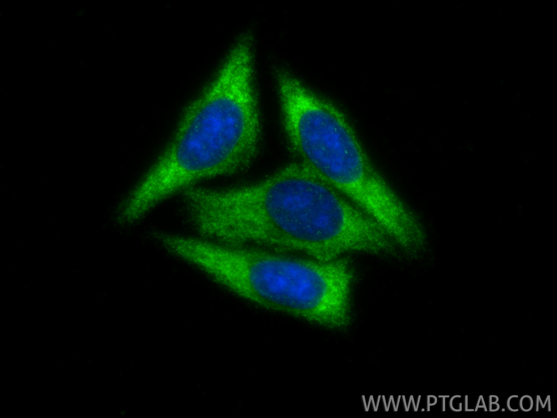 Immunofluorescence (IF) / fluorescent staining of HepG2 cells using RAB3C-specific Polyclonal antibody (16867-1-AP)