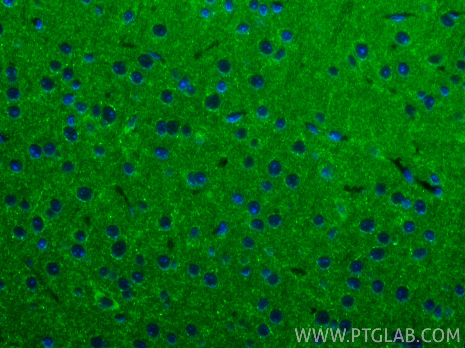 Immunofluorescence (IF) / fluorescent staining of mouse brain tissue using RAB3C-specific Polyclonal antibody (16867-1-AP)