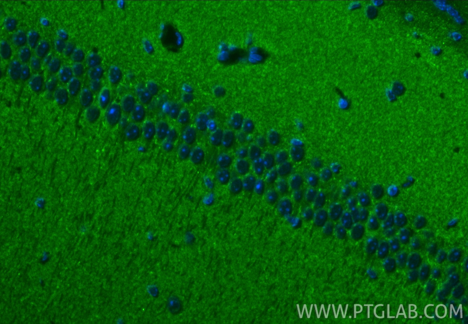 Immunofluorescence (IF) / fluorescent staining of mouse brain tissue using RAB3C-specific Polyclonal antibody (16867-1-AP)