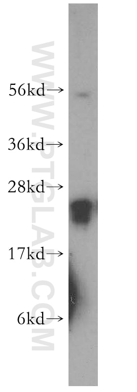 Western Blot (WB) analysis of human brain tissue using RAB3C-specific Polyclonal antibody (16867-1-AP)