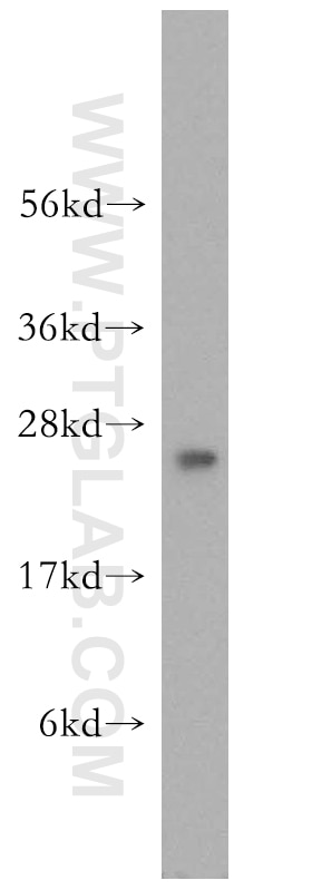 Western Blot (WB) analysis of human brain tissue using RAB3C-specific Polyclonal antibody (16867-1-AP)