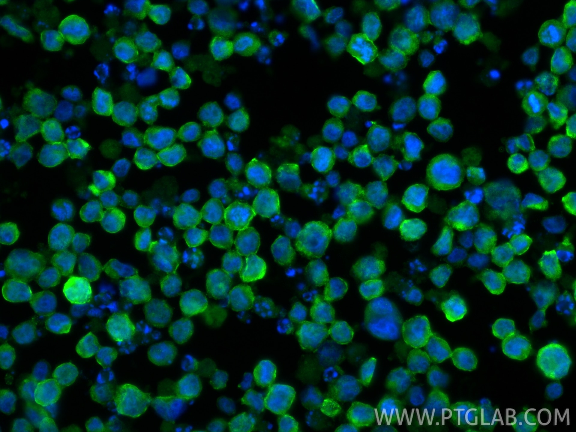Immunofluorescence (IF) / fluorescent staining of HL-60 cells using RAB3D Polyclonal antibody (12320-1-AP)