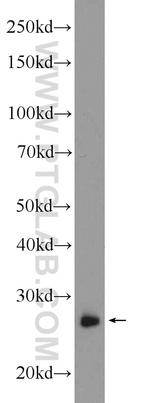 WB analysis of mouse lung using 12320-1-AP