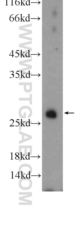 Western Blot (WB) analysis of A549 cells using RAB3D Polyclonal antibody (12320-1-AP)