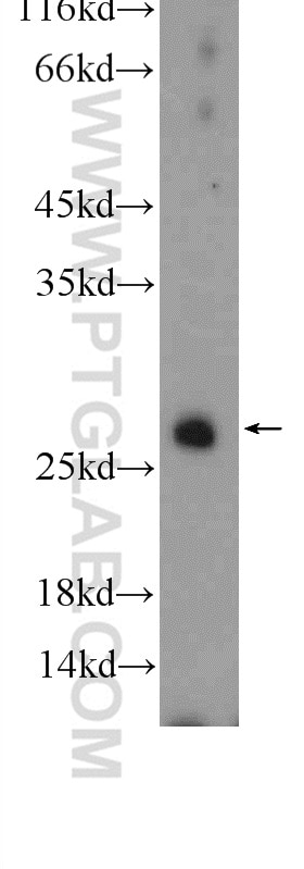 WB analysis of A549 using 12320-1-AP