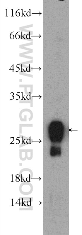 Western Blot (WB) analysis of mouse stomach tissue using RAB3D Polyclonal antibody (12320-1-AP)