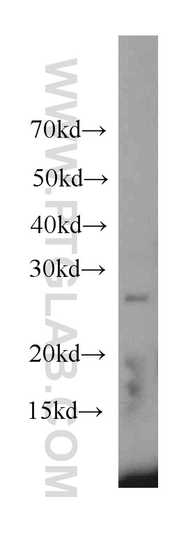 Western Blot (WB) analysis of mouse spleen tissue using RAB3D Polyclonal antibody (12320-1-AP)