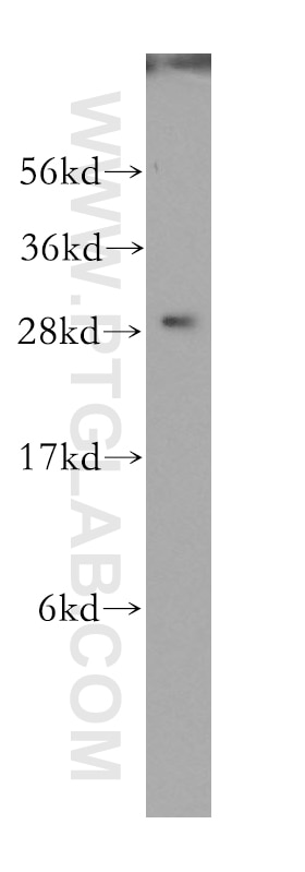 Western Blot (WB) analysis of human stomach tissue using RAB3D Polyclonal antibody (12320-1-AP)