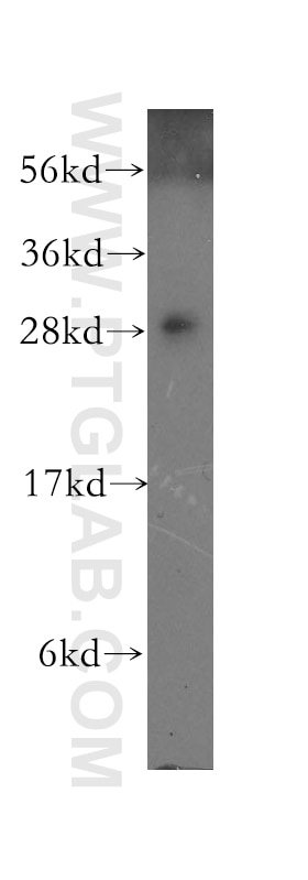 Western Blot (WB) analysis of human cerebellum tissue using RAB3D Polyclonal antibody (12320-1-AP)