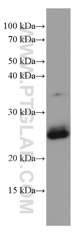 WB analysis of NCI-H1299 using 67118-1-Ig