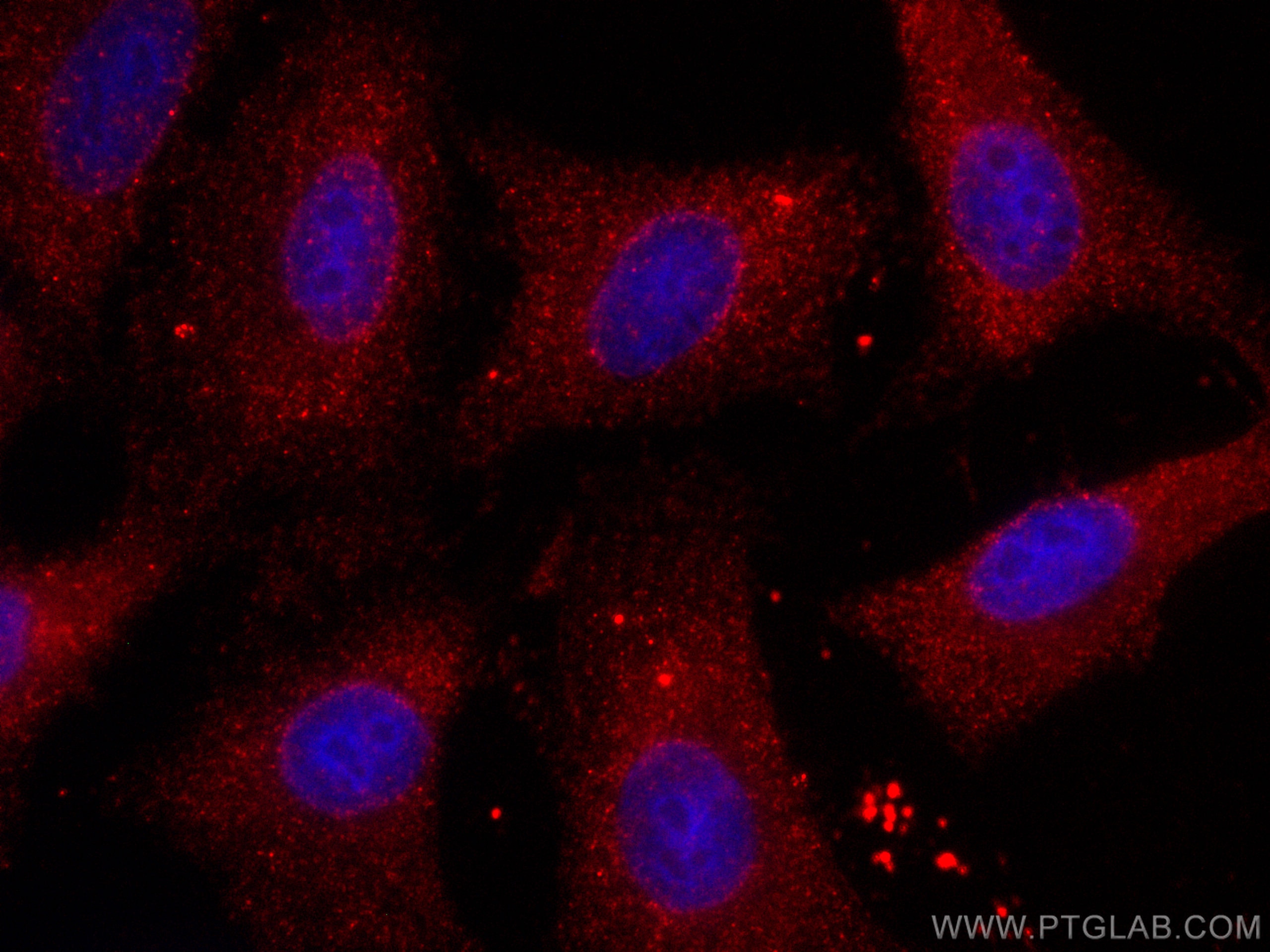 Immunofluorescence (IF) / fluorescent staining of A549 cells using CoraLite®594-conjugated RAB3D Monoclonal antibody (CL594-67118)