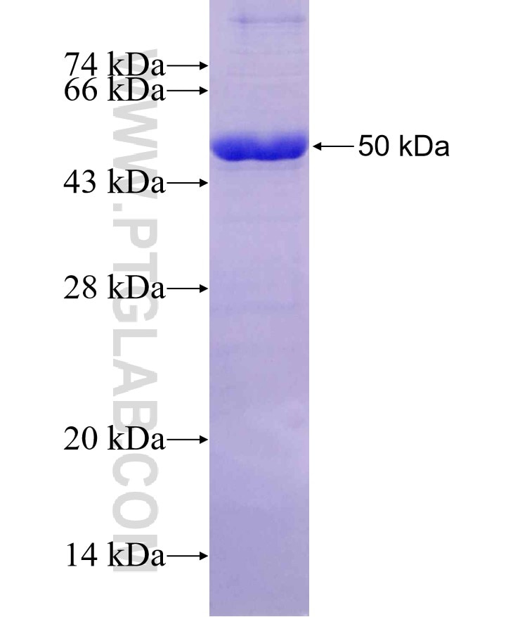 RAB3D fusion protein Ag2973 SDS-PAGE