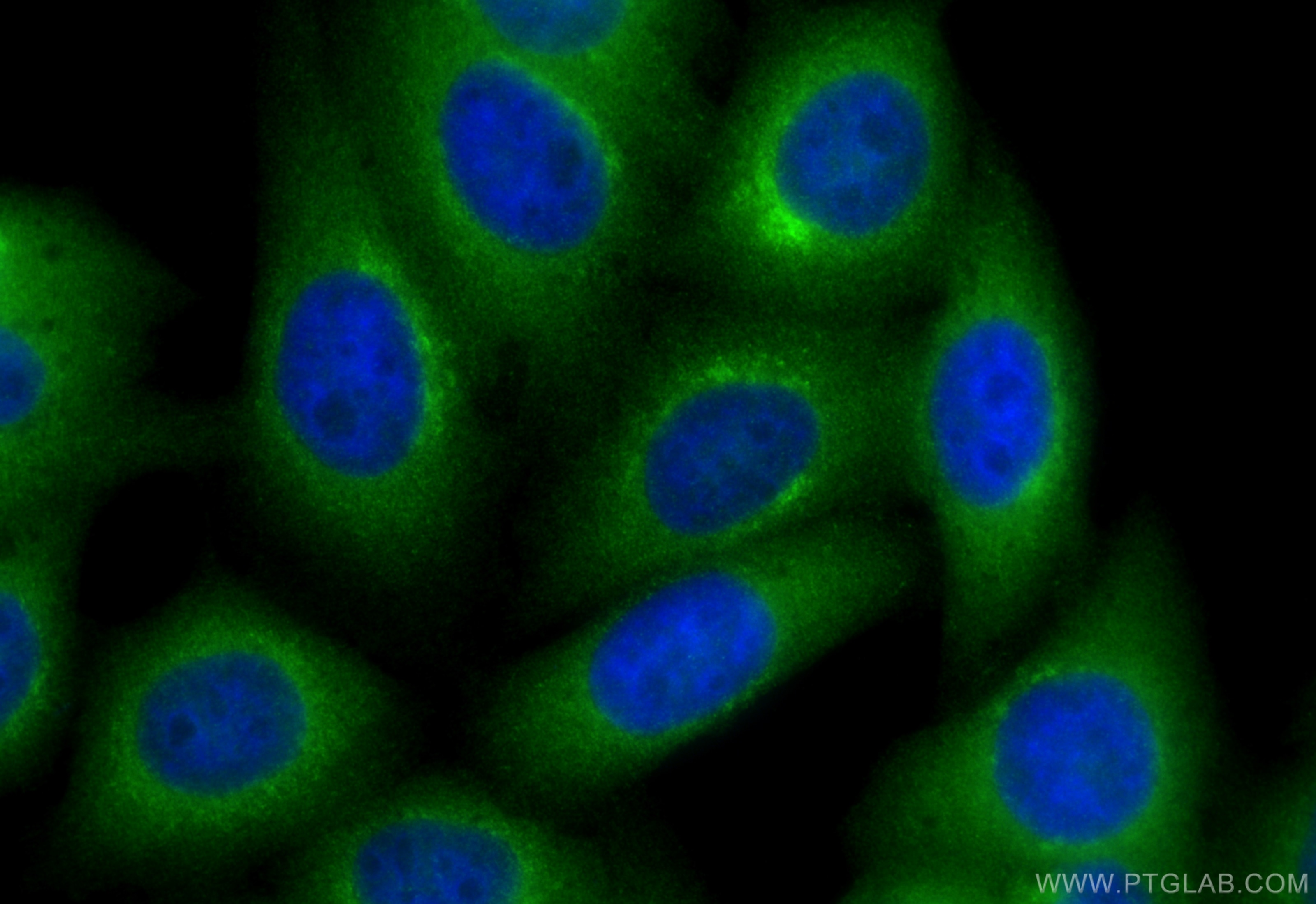 Immunofluorescence (IF) / fluorescent staining of HepG2 cells using RAB3GAP1 Polyclonal antibody (21663-1-AP)
