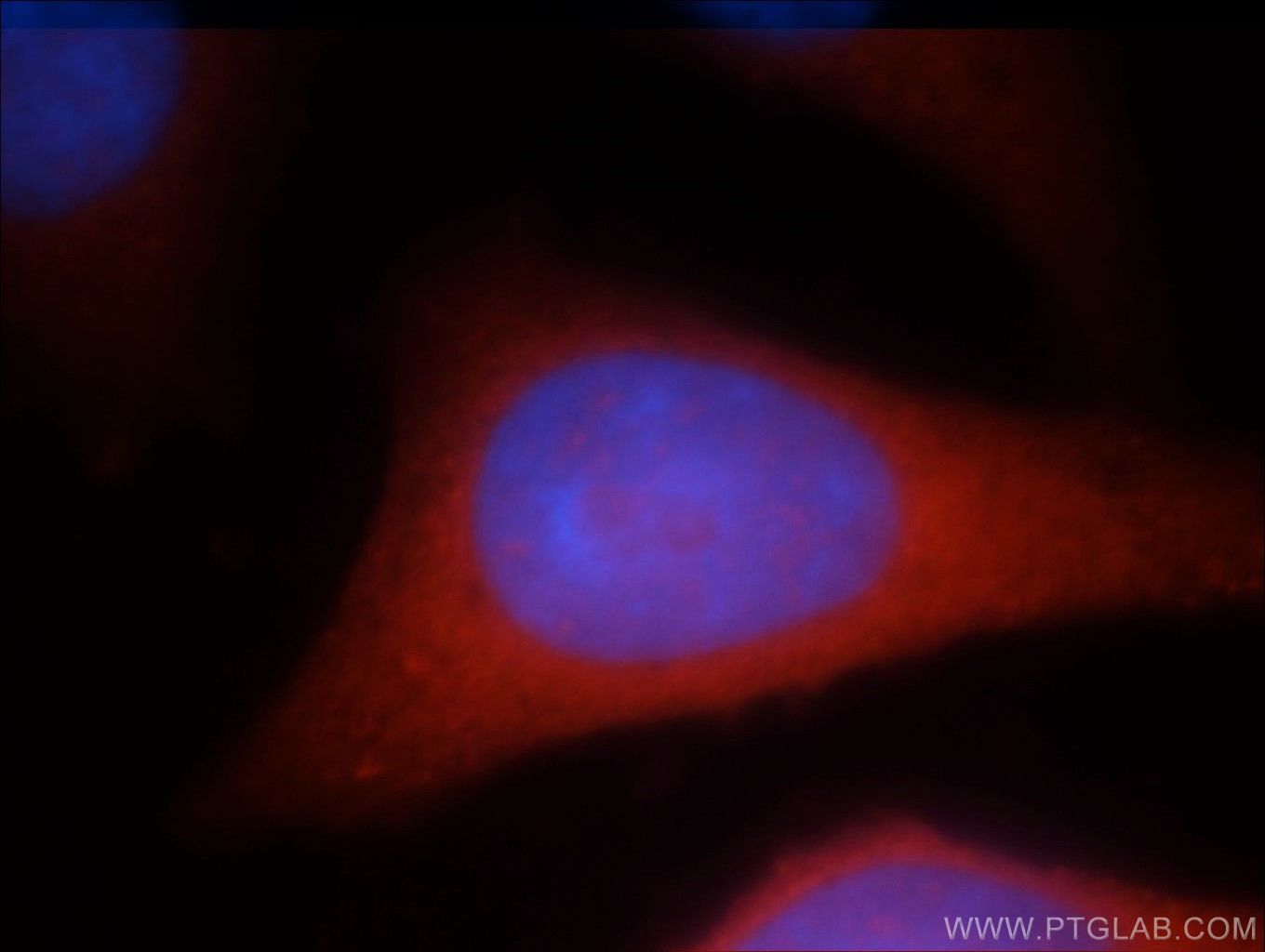 Immunofluorescence (IF) / fluorescent staining of HepG2 cells using RAB3GAP1 Polyclonal antibody (21663-1-AP)