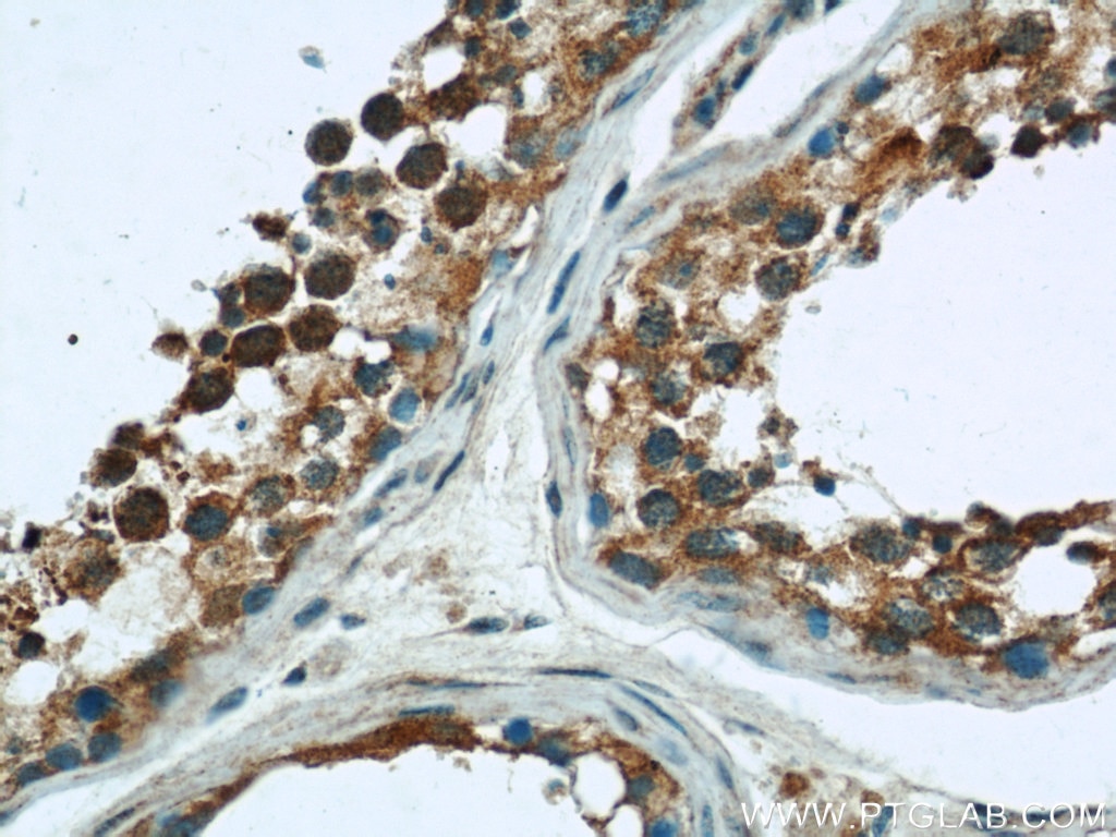 Immunohistochemistry (IHC) staining of human testis tissue using RAB3GAP1 Polyclonal antibody (21663-1-AP)