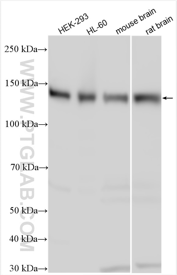 Western Blot (WB) analysis of various lysates using RAB3GAP1 Polyclonal antibody (21663-1-AP)