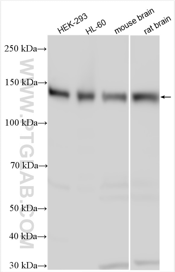 WB analysis using 21663-1-AP