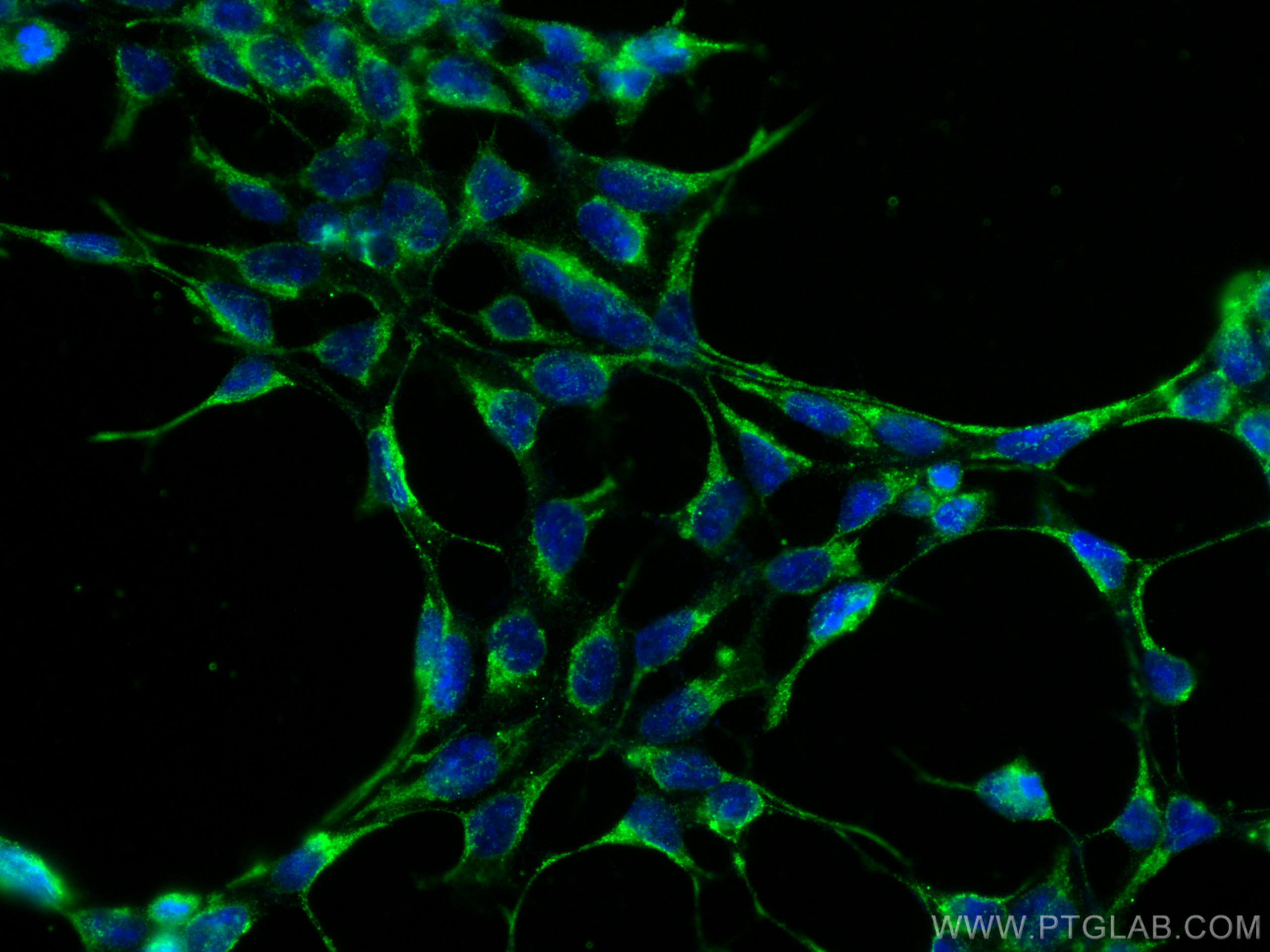 Immunofluorescence (IF) / fluorescent staining of HEK-293 cells using RAB3GAP1 Monoclonal antibody (66688-1-Ig)