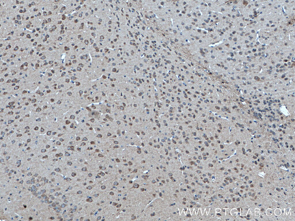 Immunohistochemistry (IHC) staining of mouse brain tissue using RAB3GAP1 Monoclonal antibody (66688-1-Ig)