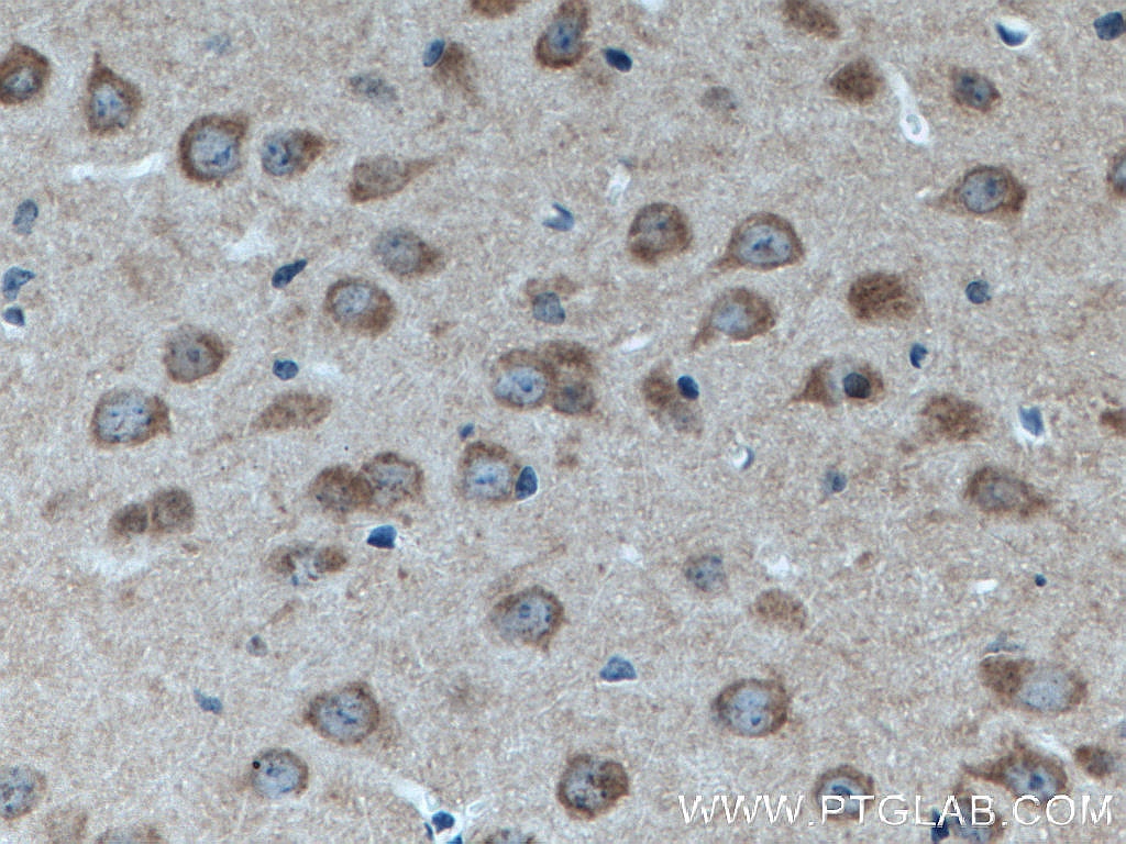 Immunohistochemistry (IHC) staining of mouse brain tissue using RAB3GAP1 Monoclonal antibody (66688-1-Ig)
