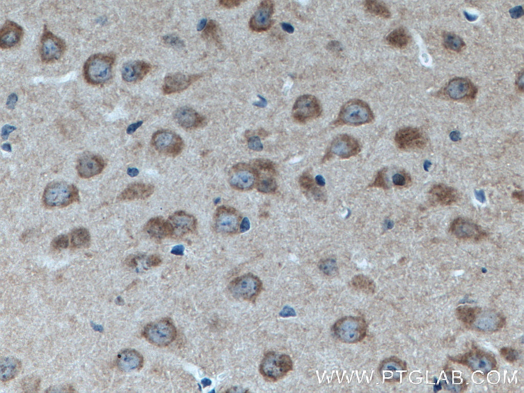 IHC staining of mouse brain using 66688-1-Ig