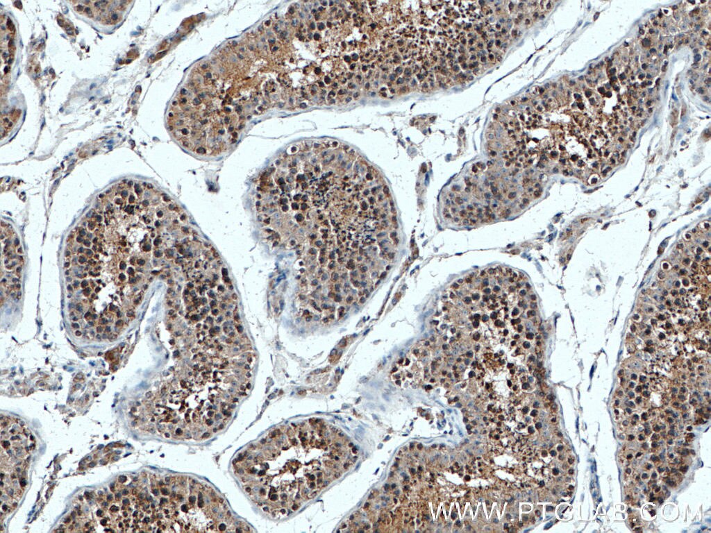 IHC staining of human testis using 66688-1-Ig