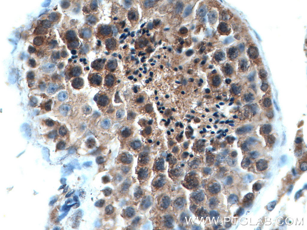 Immunohistochemistry (IHC) staining of human testis tissue using RAB3GAP1 Monoclonal antibody (66688-1-Ig)