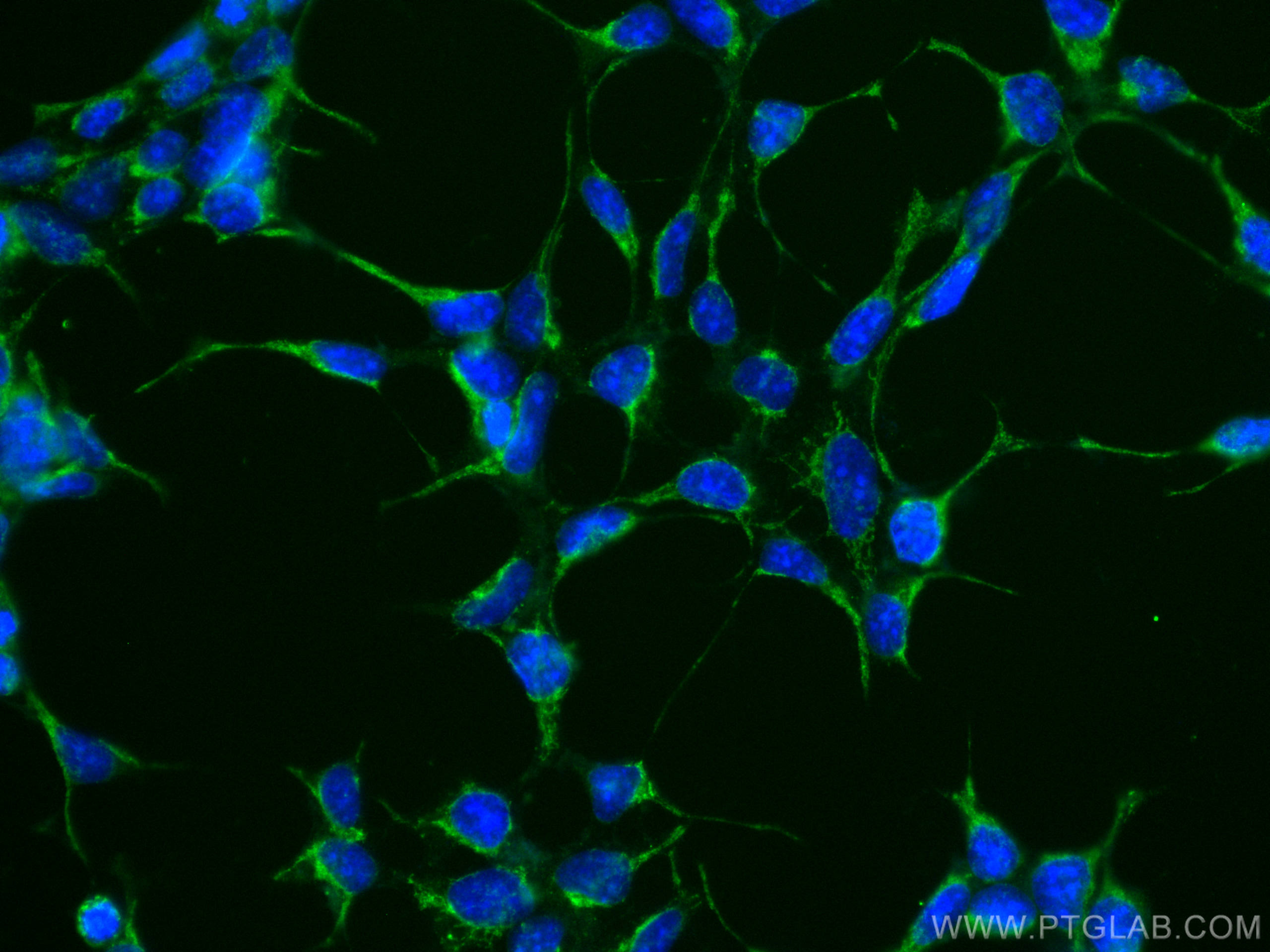 Immunofluorescence (IF) / fluorescent staining of HEK-293 cells using CoraLite® Plus 488-conjugated RAB3GAP1 Monoclonal  (CL488-66688)